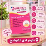 حل مثالي لحب الشباب